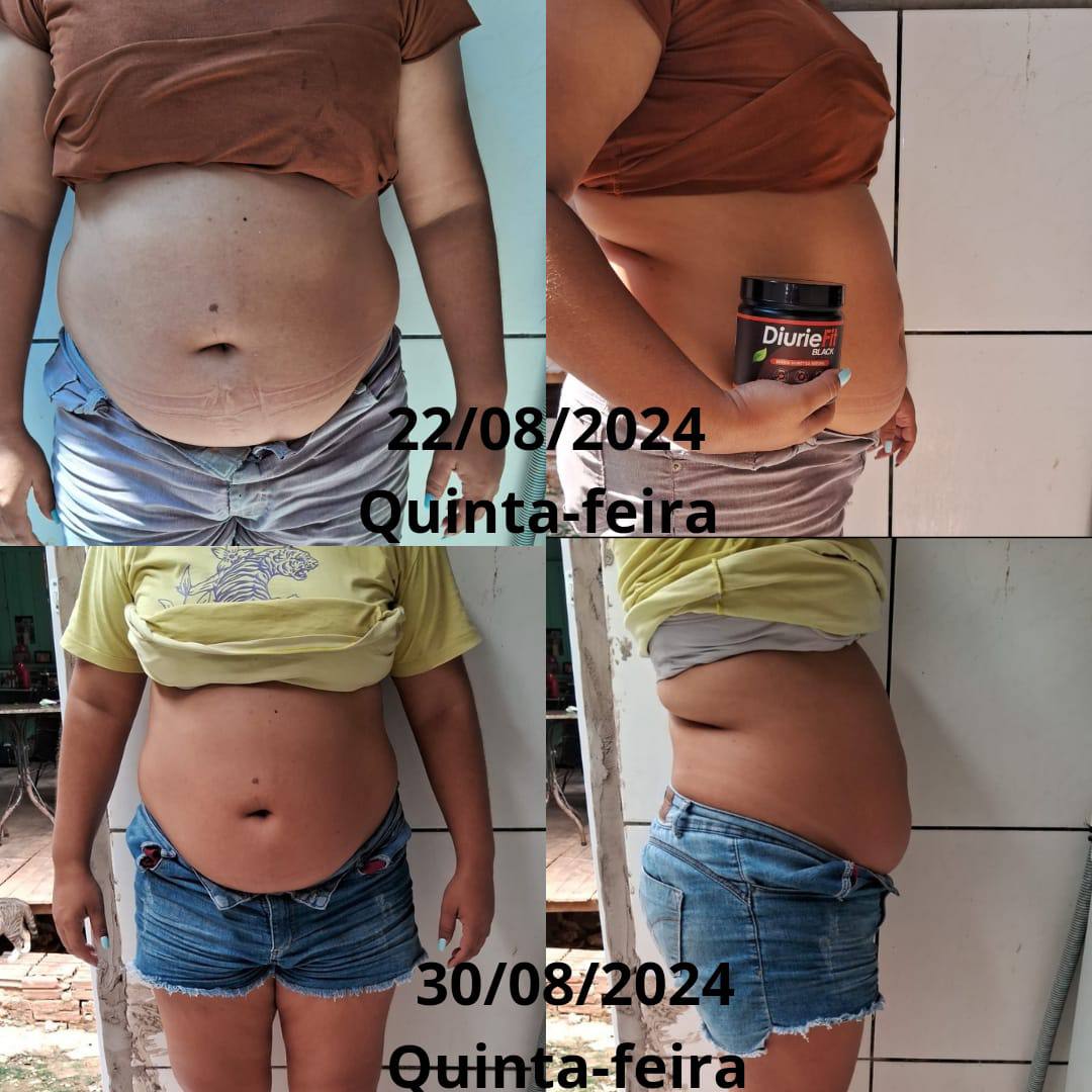 Antes e depois usando Diuriefit Black