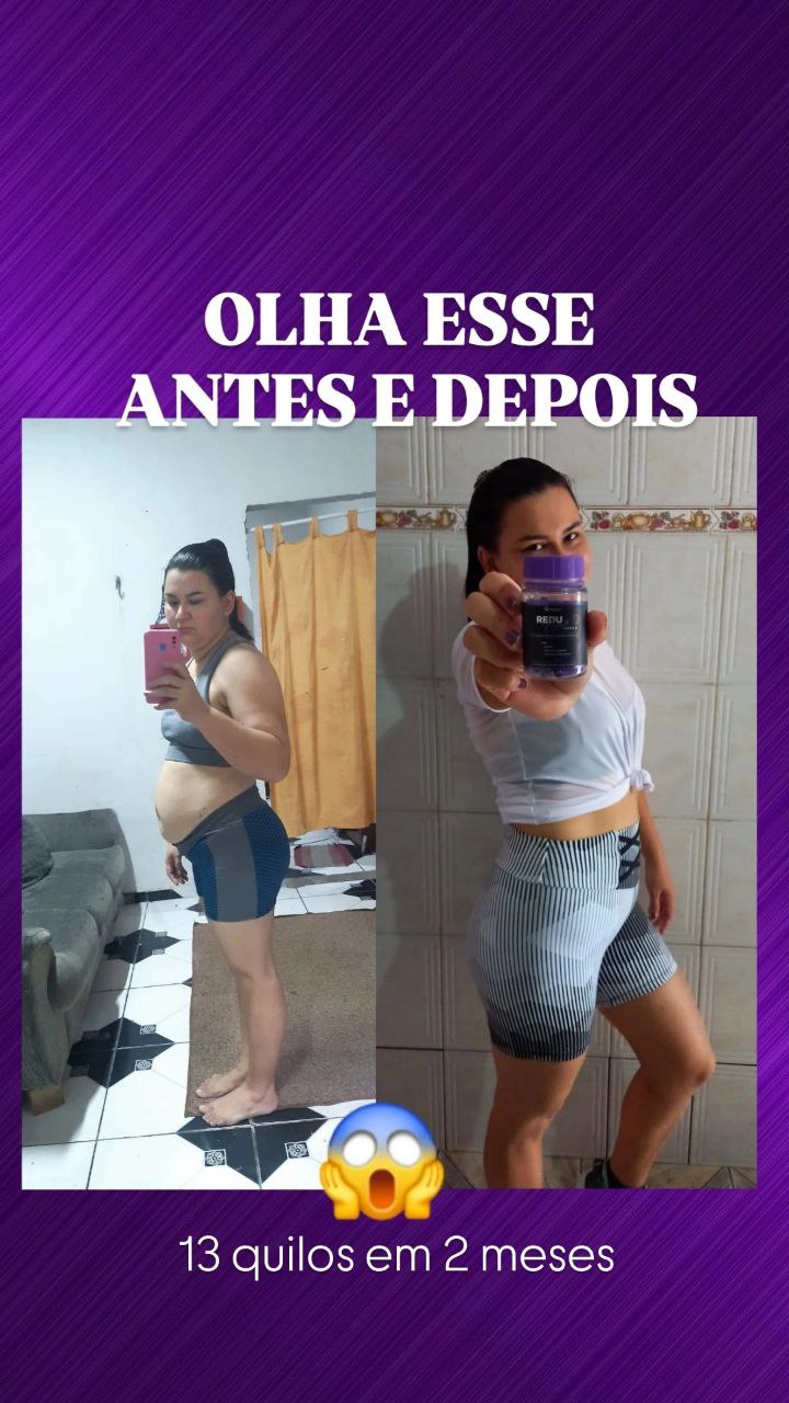 Resultado obtido por uma pessoa usando o Reduphine Premium