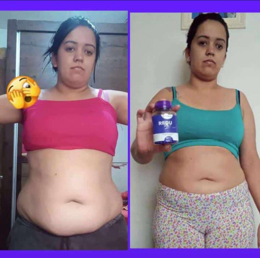 Resultado obtido por uma pessoa usando o ReduPhine Caps